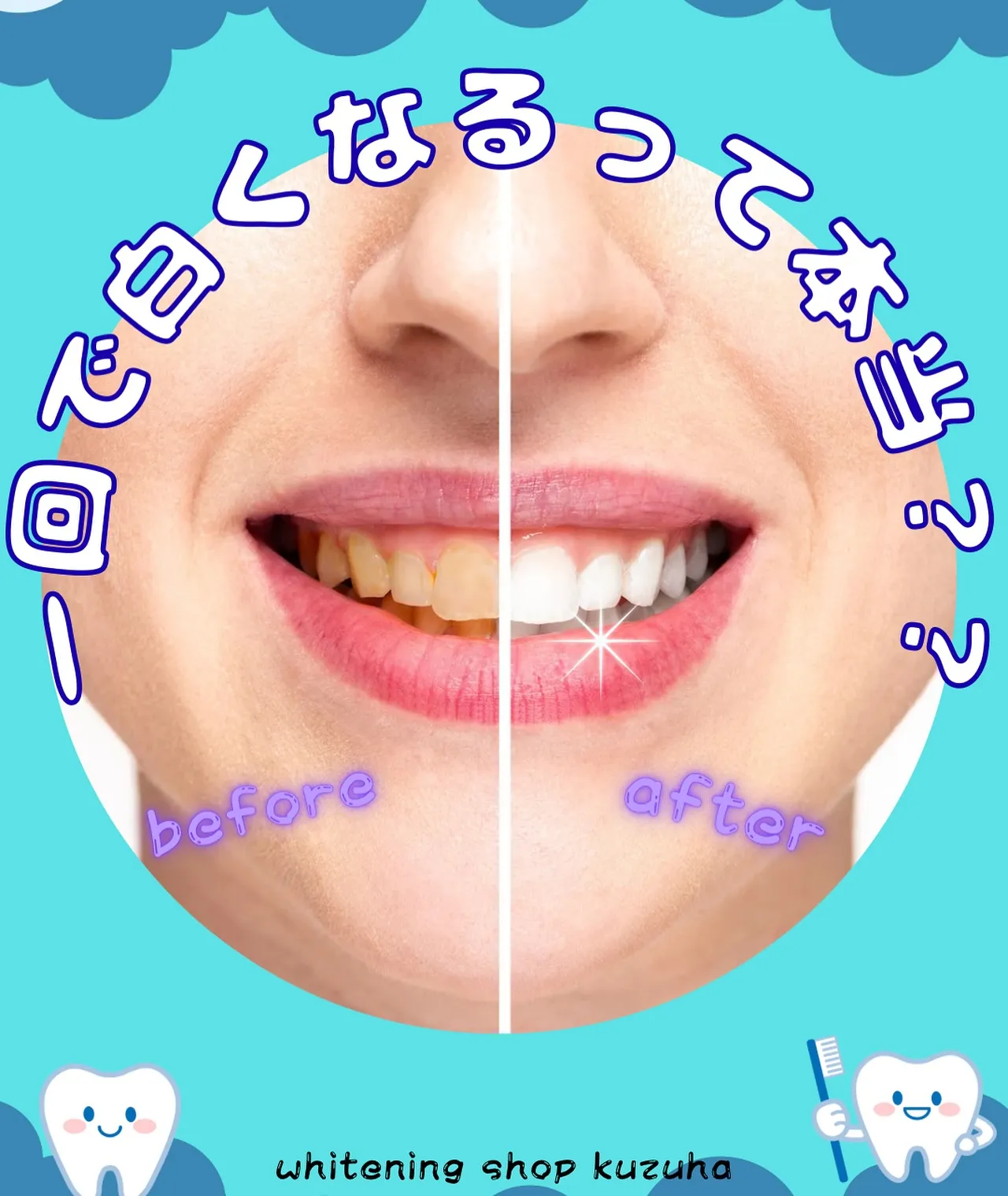 【一回で白くなるって本当？？】